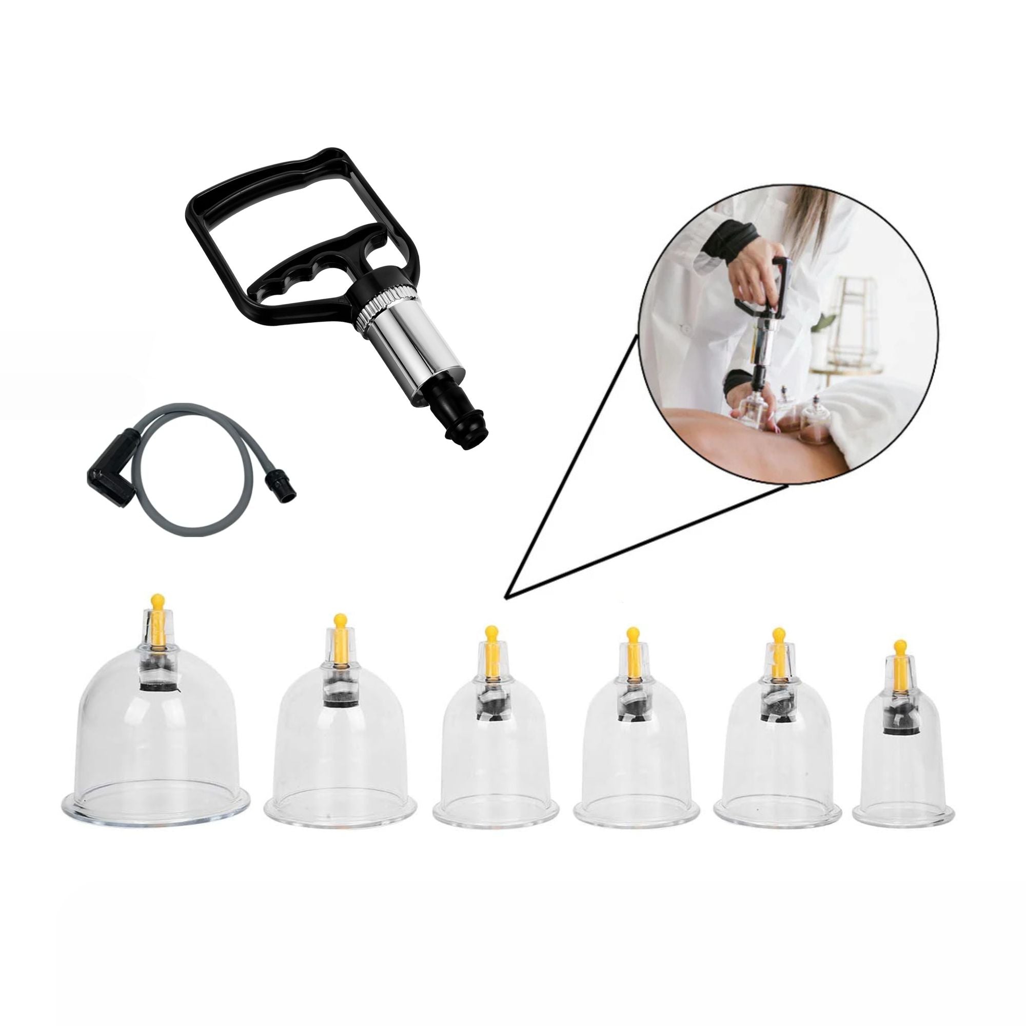TheraCups™ — Professional Cupping Therapy Set