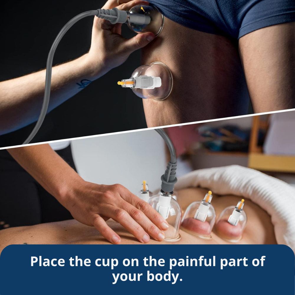 TheraCups™ — Professional Cupping Therapy Set