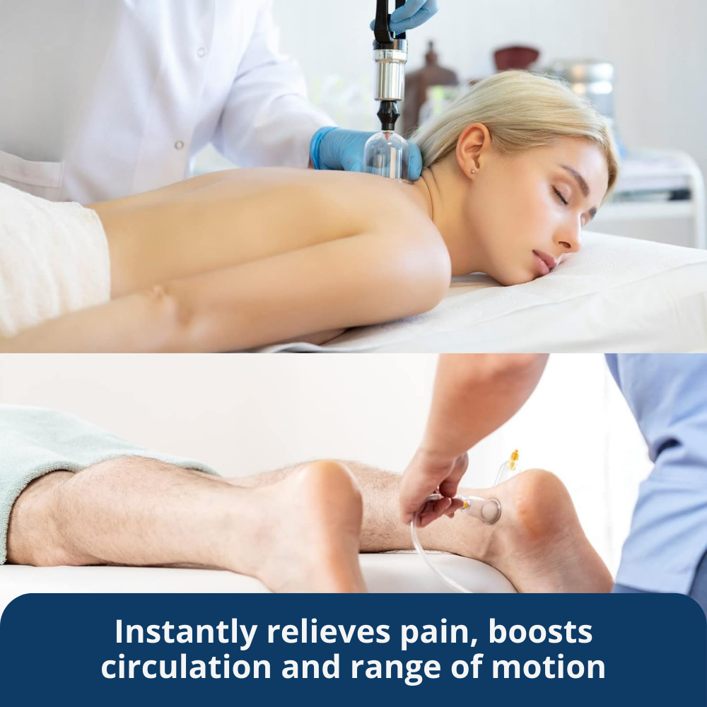TheraCups™ — Professional Cupping Therapy Set